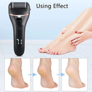 Rechargeable Electric Foot File Pedicure Kit With 3 Rollers And LCD Display – view 5