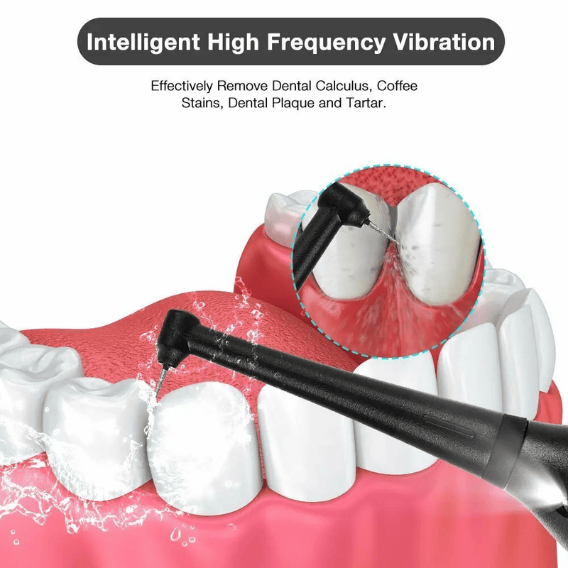Electric Dental Calculus Remover Tooth Cleaner – view 8