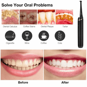 Electric Dental Calculus Remover Tooth Cleaner – view 9