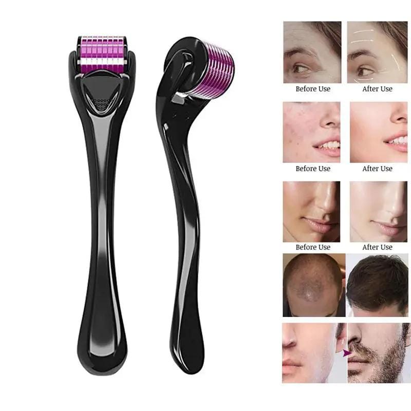 salelink.co.nz Unbranded 540 Microneedle Scar Derma Roller 0.3mm 540 Microneedle Scar Derma Roller 0.3mm | Action Outdoors NZ