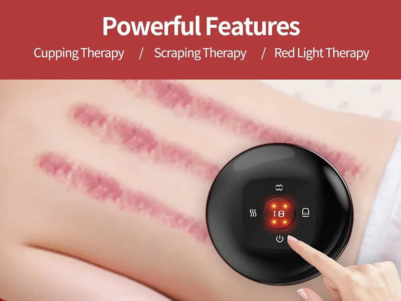 Loveliving Health & Beauty Smart Dynamic Cupping Therapy Set Smart Dynamic Cupping Therapy Set