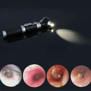 Magnification Ear Scope with LED Direct Illumination Light – view 3